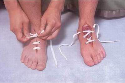 mis zapatitos ya no tienen brillo...